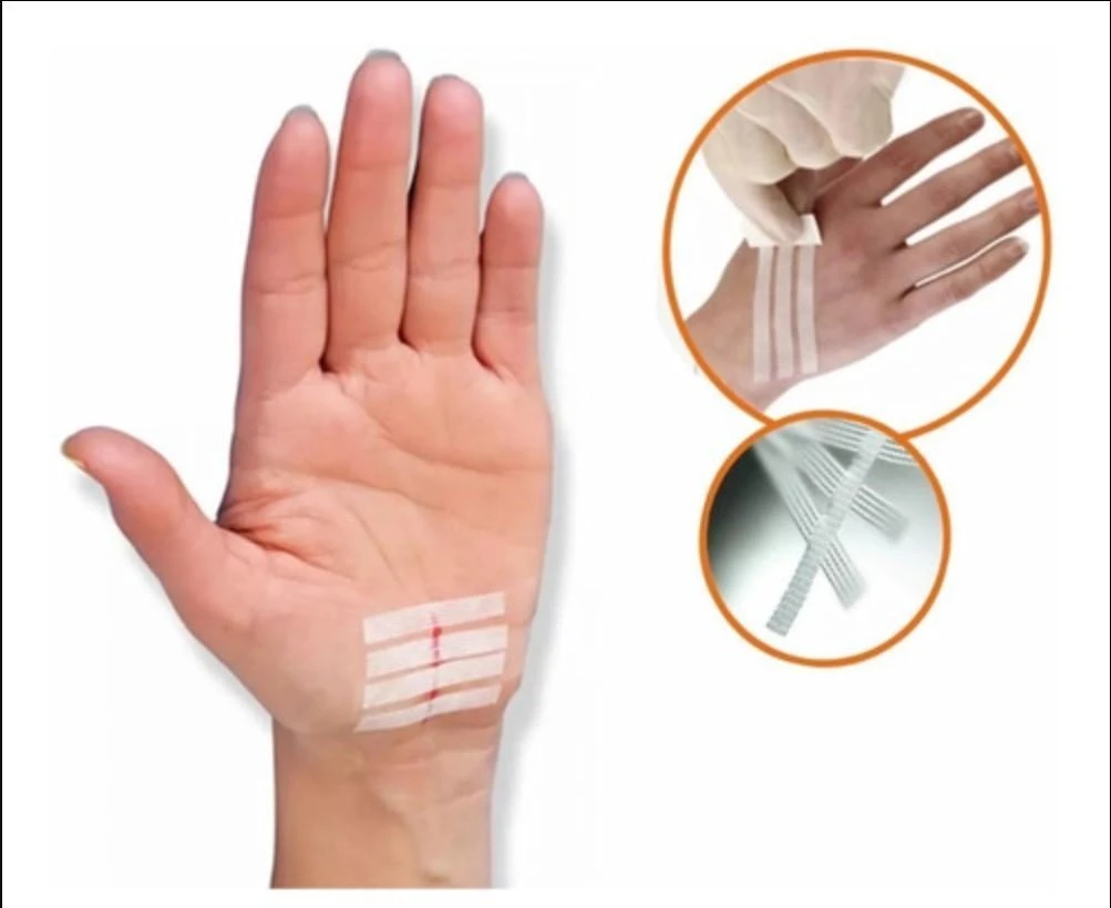 Miniatura Sutura Cutânea Ponto Falso Kelogel Strip 12Mmx100Mm 120Un