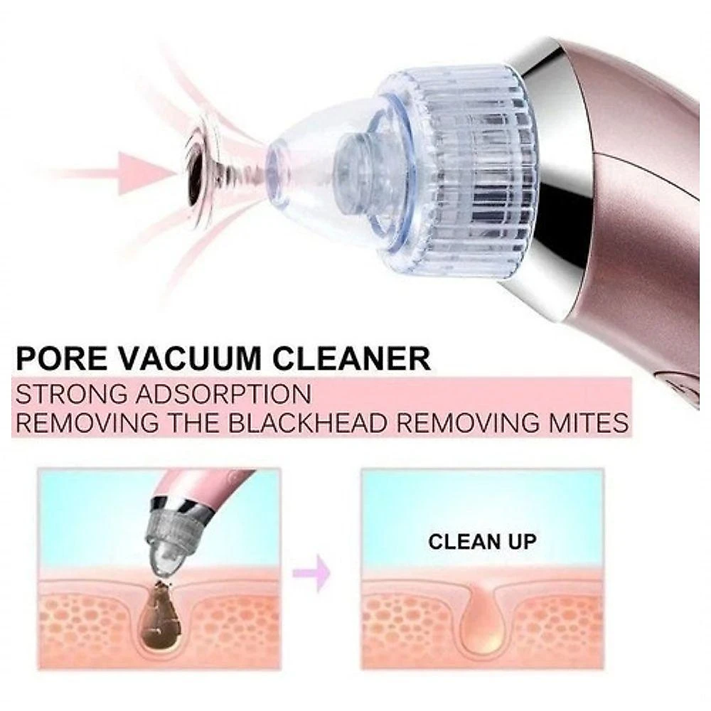 Máquina Sucção A Vácuo Remove Cravos Aparelho Acne Cleaning