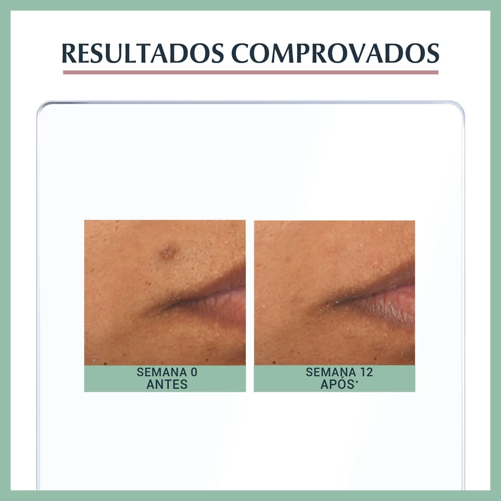 Miniatura Eucerin Dermo Pure Oil Control Sérum Efeito Triplo 40ml