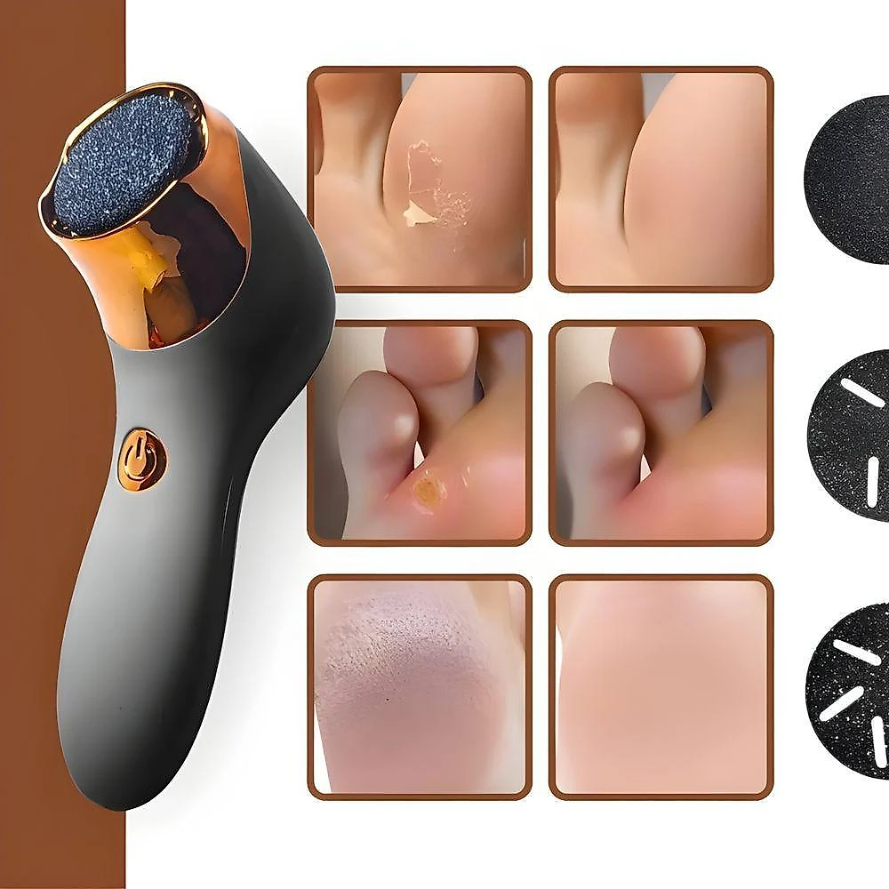 Kit Removedor Elétrico de Calos para Pés Recarregável 3 Cabeças Cinza Utimix