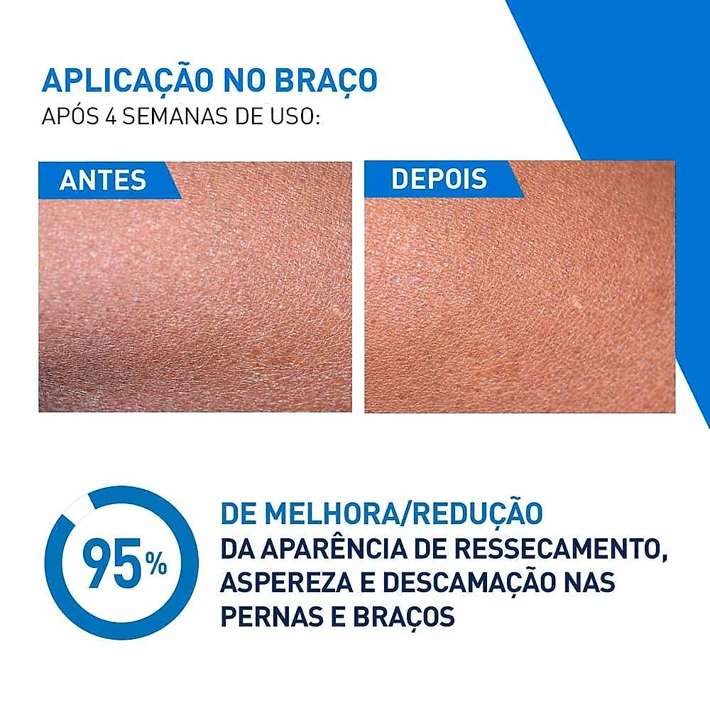 Loção hidratante intensiva cerave 5% hidro-urea 200ml